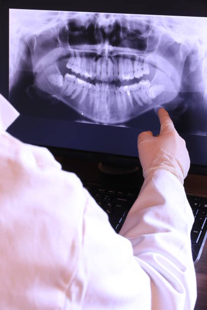 Best Emergency Root Canal Treatment in Worthington, MN