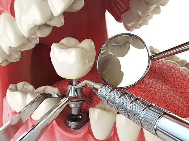Best Emergency Gum Treatment in Worthington, MN